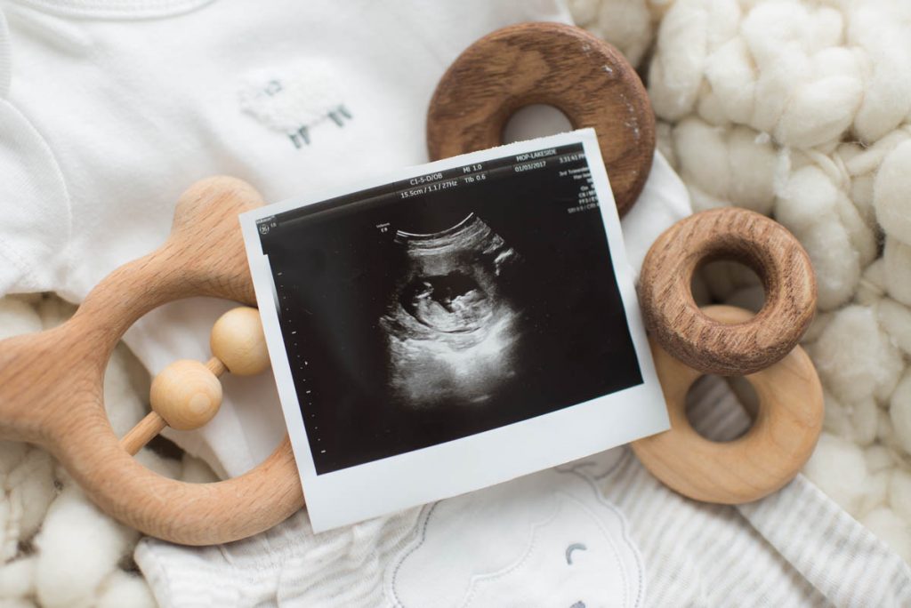 ultrasound and baby toys for teacher pregnancy reveal
